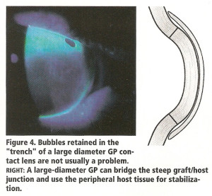 dicembre2002-pag30-fig4